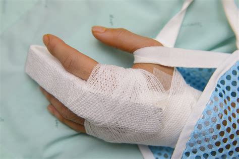 How To Treat A Broken Finger All Pro Orthopedics And Sports Medicine