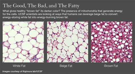 How Beige Fat Could Fight Obesity Uc San Francisco