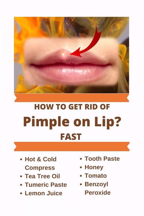 How To Get Rid Of Pimple On Lip Line