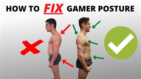 How To Fix Gamer Posture Youtube