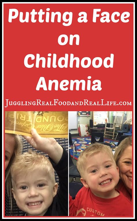 A Mothers Story Of Childhood Anemia
