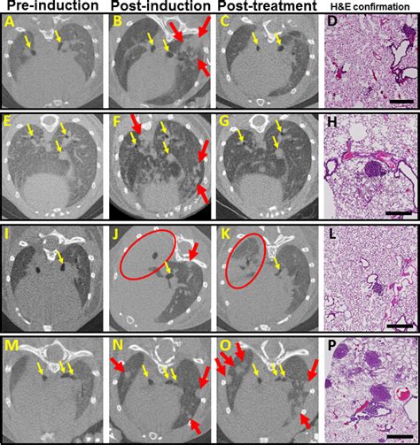 Using Micro Computed Tomography For The Assessment Of Tumor Development