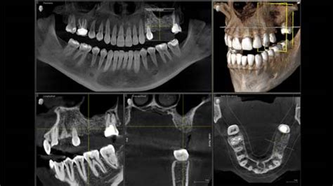 radiologia digitale   poliambulatorio odontoiatrico