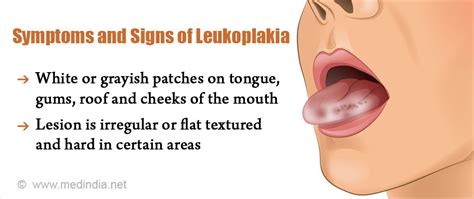 Typical precancerous skin lesions include lentigo maligna, which may. Leukoplakia - An Overview of Causes, Symptoms & Treatment