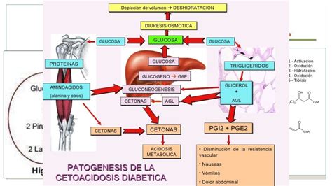 Cetoacidosis Diabetica Y Estado Hiperosmolar Hiperglucemico
