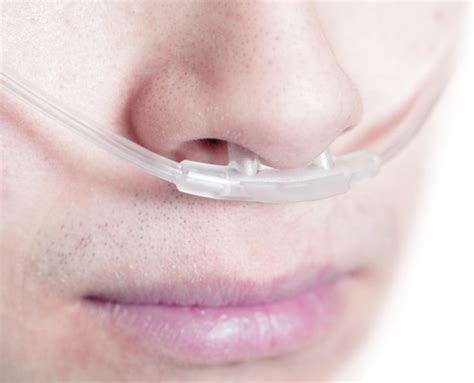 Oxygen Nose Tube Placement Cheaper Than Retail Price Buy Clothing Accessories And Lifestyle