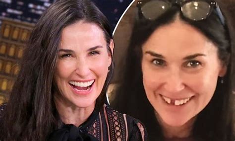 Demi Moore Reveals She Lost Two Front Teeth Due To Stress Daily Mail