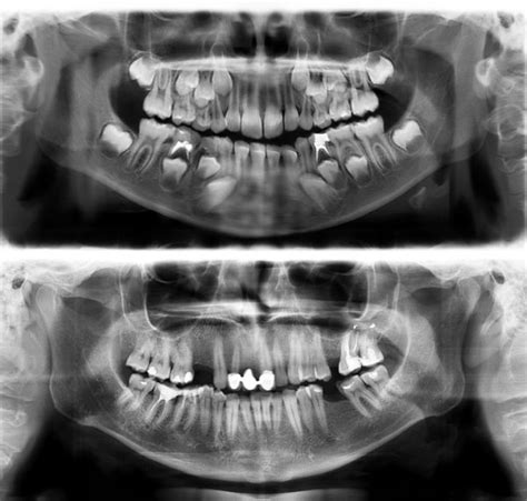 Many of our patients are undergoing orthodontic treatment and so we are asked this question quite often. Interesting X-Rays And Scans (22 pics)