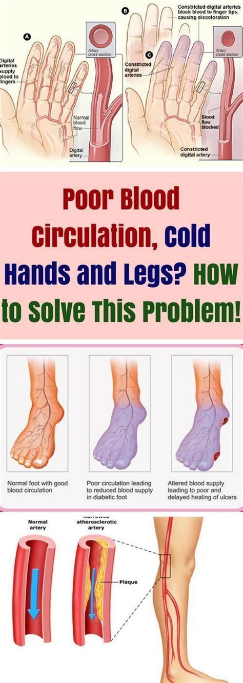 How To Improve Blood Circulation In Legs And Feet Unugtp News
