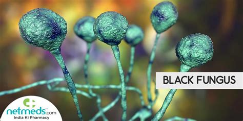 Mucormycosisblack Fungus Why Are Covid 19 Patients At Risk Here Are