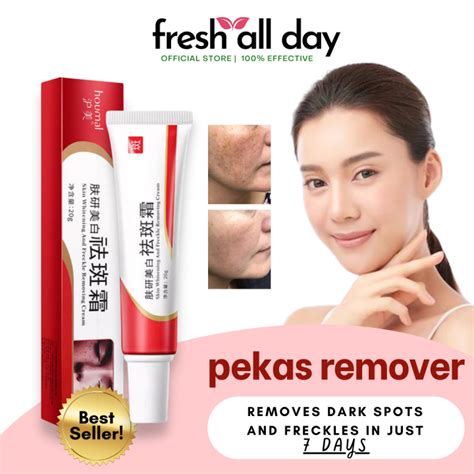 Pekas Remover Effective Whitening And Freckle Remover Cream Melasma Cream Niacinamide Serum