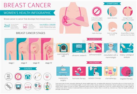 breast cancer medical infographic diagnostics symptoms treatment women`s health set stock