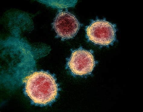 Surfaces Sneezes Sex How The Coronavirus Can And Cannot Spread The