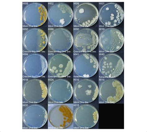 Colony Morphology Of Bacteria