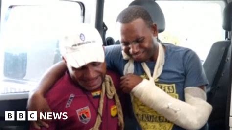 Papua New Guinea Police Fire On Student Rally Casualties Feared Bbc News