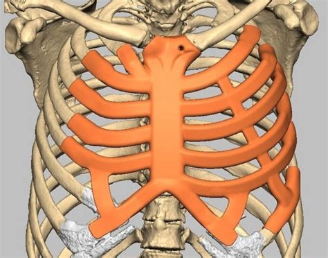 Incredible World First Ribcage Implant Becomes Alive The Leaders Online