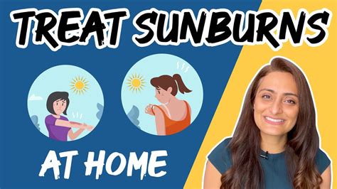 How To Treat Sunburn At Home Sunburn Causes And Treatment Dr Aanchal