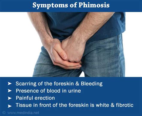 Phimosis Tight Foreskin Causes Symptoms Diagnosis