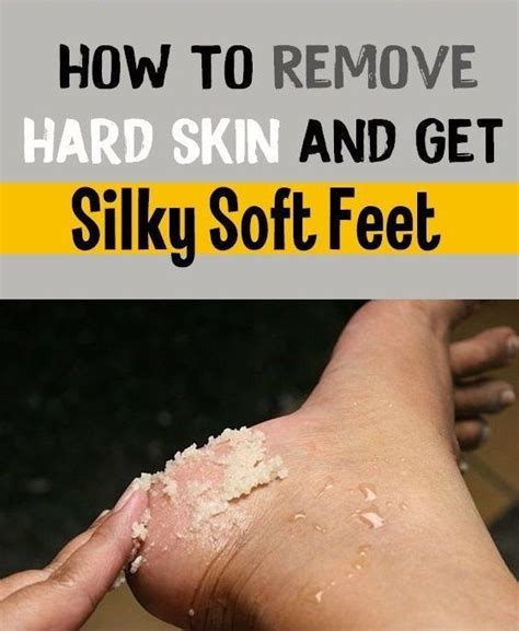 How To Remove Hard Skin And Get Silky Soft Feet Dry Skin On Feet Hard