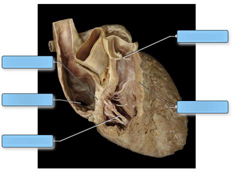 Labeling The Cadaver Heart Internal Anatomy 1 Diagram Quizlet