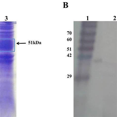 Protein Migration In Sds Page Acrylamide Of Protein Samples