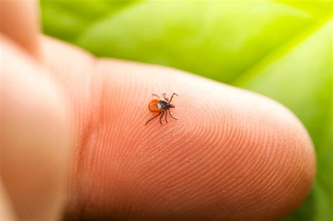 Tick Bites Learn The Signs Symptoms And Treatment