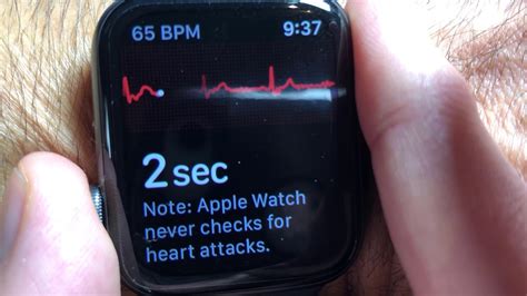 How To Use Apples Ecg App On The Apple Watch And Phone Youtube