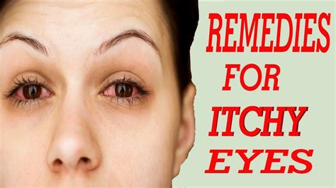 10 Best Home Remedies For Itchy Eyes Home Remedies For Itchy Eyes