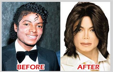 Michael Jackson S Plastic Surgery Fail Beauty Faxo