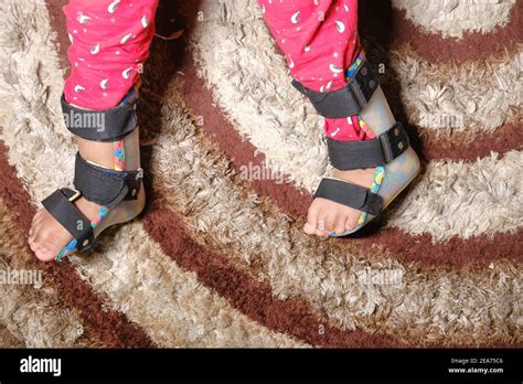 Child Cerebral Palsy Disability Legs Orthosis Stock Photo Alamy