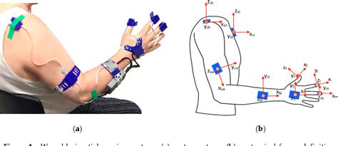 Figure 1 From Assessment Of Upper Limb Movement Impairments After