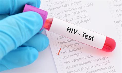 Cure For Hivaids Sex Based Treatment Will Work As Hiv Is Different In