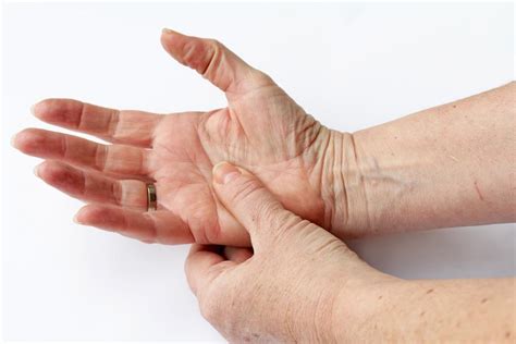 8 Early Signs Of Arthritis In Hands Can Steps Help You Lose Weight