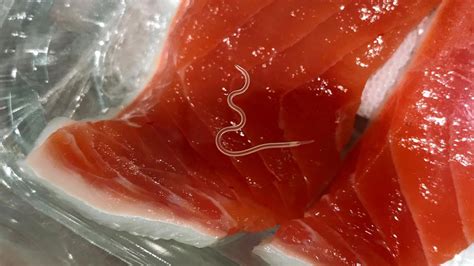 Parasites Are Growing More Common In Some Fish Species Used In Sushi