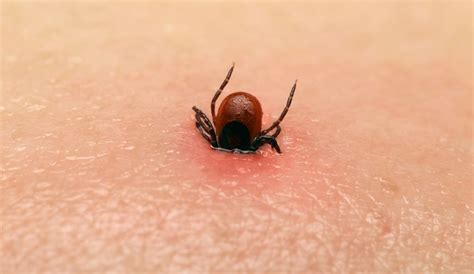 Learn About Tick Removal While Visiting Costa Rica Q Costa Rica