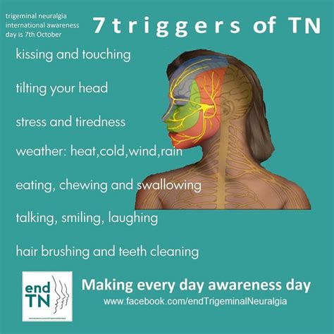 7 Triggers Of Tn Trigeminal Neuralgia Neuralgia Neuralgia Symptoms
