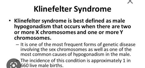 Klinefelter Syndrome Klinefelter Syndrome Is Best Defined As Male Hypog