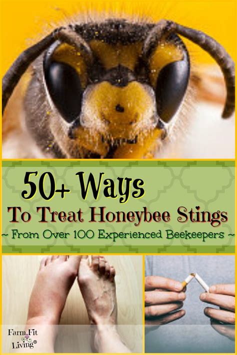 50 Ways To Treat Honey Bee Stings From Over 100 Beekeepers