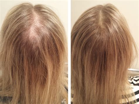 So why exactly does your hair get thinner?: 5 Ways to Hide Thinning Hair - SIS HAIR