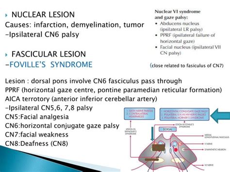 Multiple Cranial Nerve Palsy Final Ppt