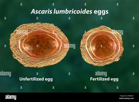 Illustration Of The Unfertilized And Fertilized Eggs Of Ascaris