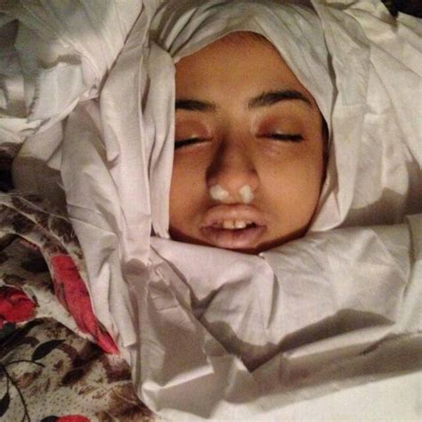 مقتل فتاة برصاص قناصة حوثيين في كريتر بعدن ومواجهات متقطعة في المعلا المصدر أونلاين