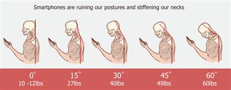 why chiropractors say posture is so important