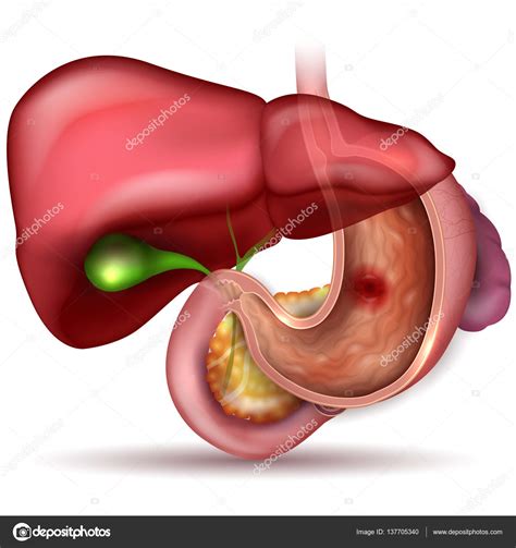 Ulcera Allo Stomaco Anatomia Di Organi Interanl Colorato Disegno