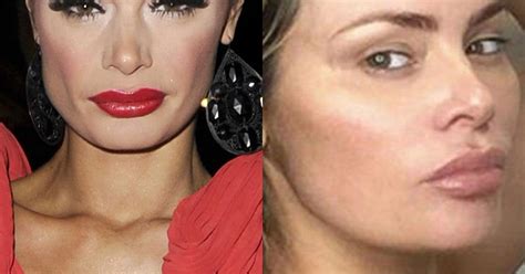 Chloe Sims Plastic Surgery Before And After The Truth Behind The Towie Stars Cosmetic Surgery