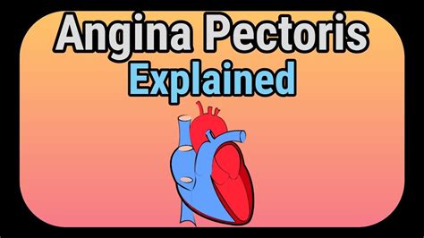 Angina Pectoris Explained How It Is Caused Youtube