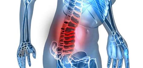 Stop Back Spasms With This Exercise Low Back Pain Program