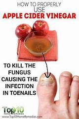 Photos of Do Home Remedies Work For Toenail Fungus
