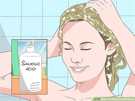 4 Ways To Heal Scalp Eczema Wikihow