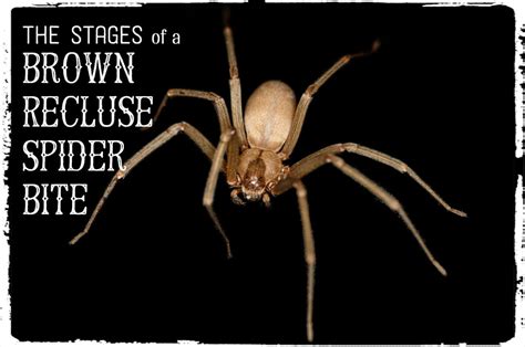 Brown Recluse Bite Pictures Stages Symptoms And Treatment
